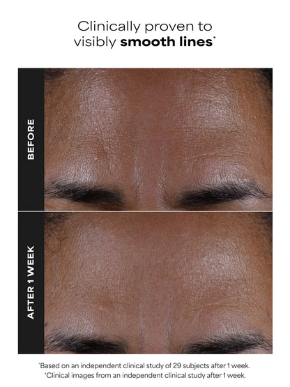 PAULA'S CHOICE SKIN PERFECTING 2% BHA Liquid Exfoliant